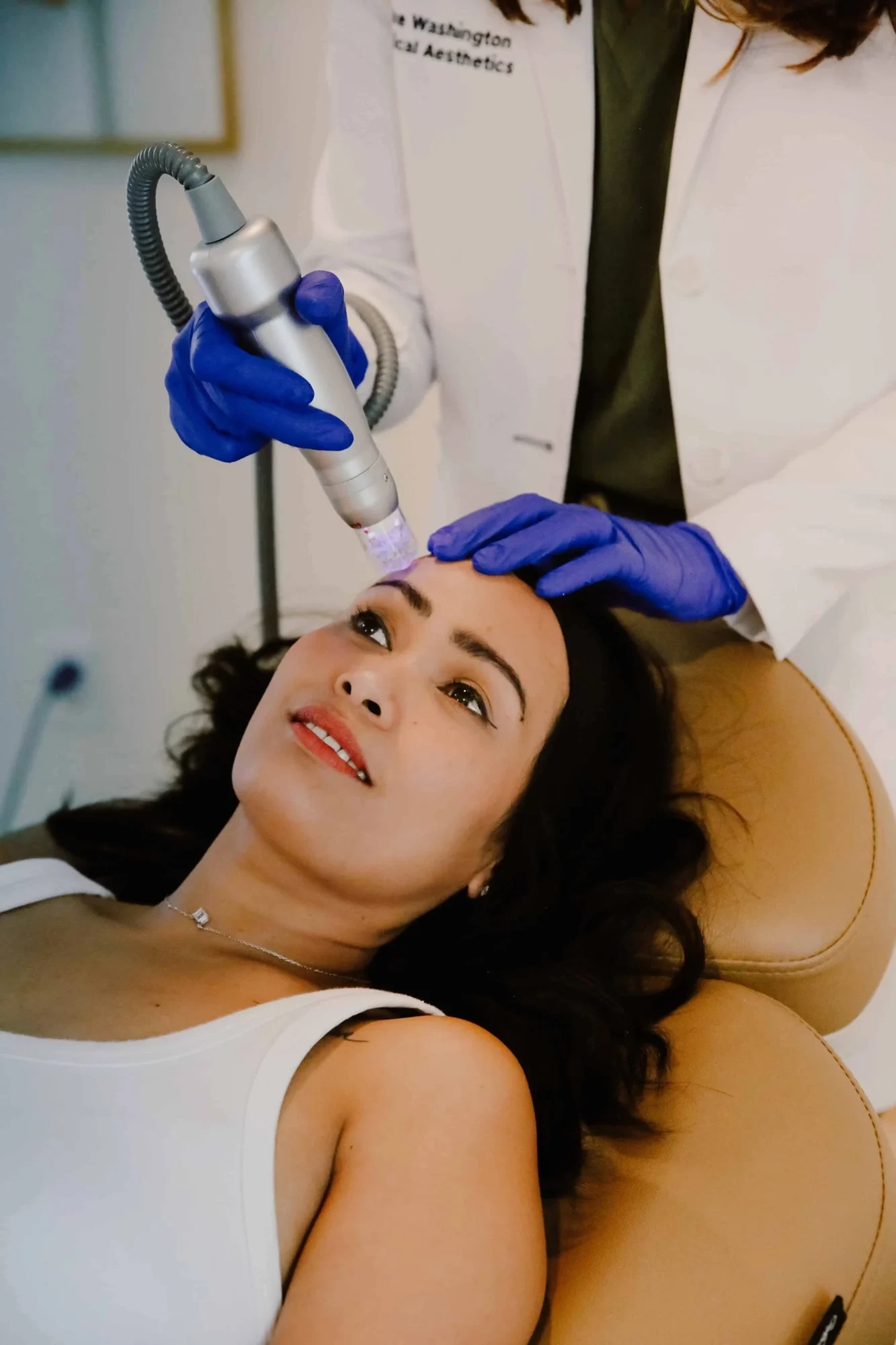 RF Microneedling in Kirkland WA