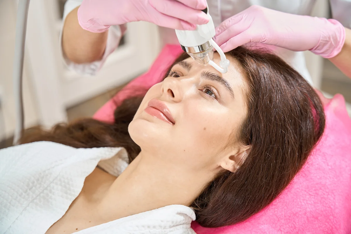 RF Microneedling by lake washington medical aesthetics in kirkland WA two