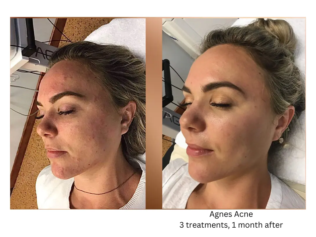 a collage of a woman with her eyes closed lake washington medical aesthetics kirkland WA
