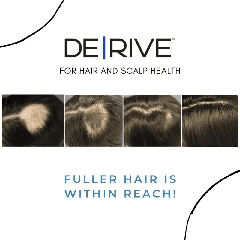 a collage of hair loss treatment lake washington medical aesthetics kirkland WA