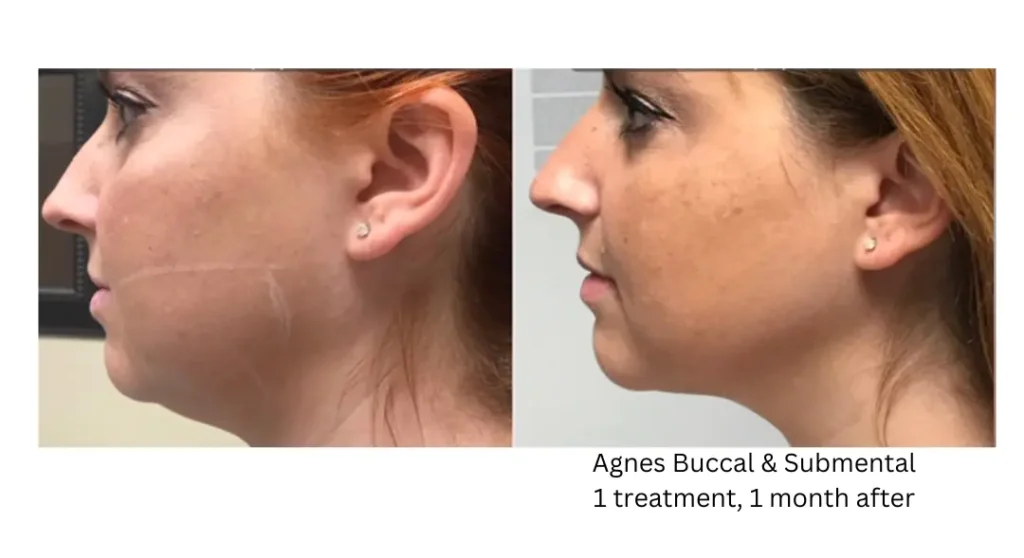 bA lake washington medical aesthetics kirkland WA